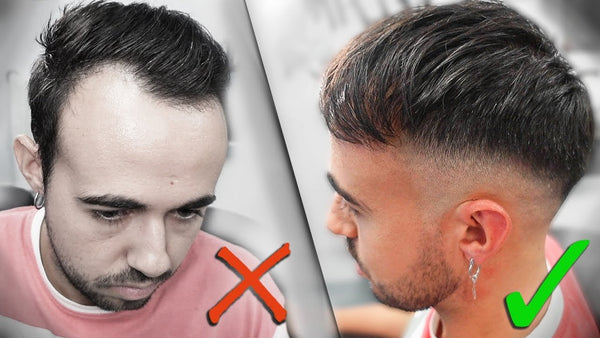 Corte de pelo para tapar tus entradas – Peinado para disimular entradas